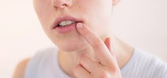 Herpes Symptome Ubertragung Behandlung