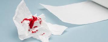 Blut Im Stuhl Erkennen Ursachen Und Untersuchung Focus Arztsuche