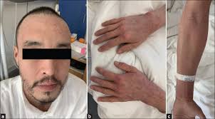 2024.2.19.Skin_diseases_Greenland