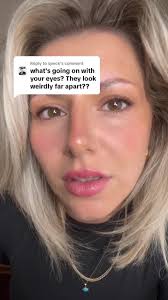 Jessie's Far Apart Eyes