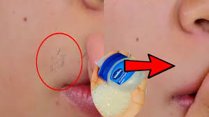 This Woman Used Toothpaste As A Diy Hair Remover And I'M Shook - How To Wax  Your Skin At Home