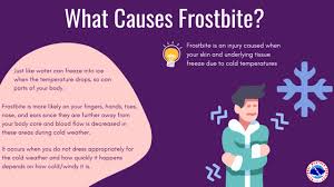 Image result for Cold Weather Injury