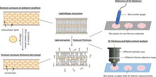 1,116 likes · 4 talking about this. Optimal Configuration Of Confocal Raman Spectroscopy For Precisely Determining Stratum Corneum Thickness Evaluation Of The Effects Of Polyoxyethylene Stearyl Ethers On Skin Sciencedirect