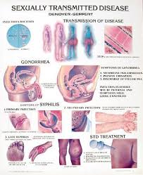 Sexually Transmitted Diseases Chart