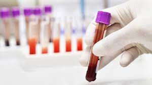 Tumor markers are chemicals made by tumor cells that can be detected in your blood. Newly Developed Blood Test Can Detect Cancer Four Years Before Conventional Methods Technology Networks