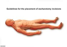 About press copyright contact us creators advertise developers terms privacy policy & safety how youtube works test new features press copyright contact us creators. The Virtual Patient Case 1 Images