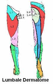 Ruckenschmerzen Reflexe Und Dermatome