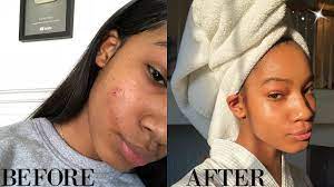 The skin reflects overall health, so if you nourish your body with plenty of exercise and good, healthy food, your skin will look great as well. How To Get Perfect Skin For Back To School 2018 Youtube