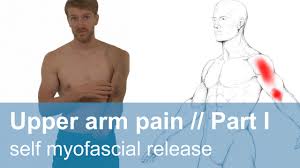 The hand, the arm, and the forearm. Muscle Pain In The Upper Arm Front Self Treatment