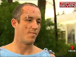 FIRST ON 7: Police brutality claims