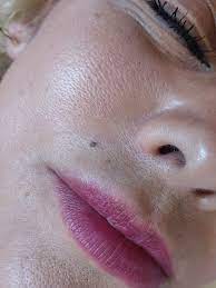 Get fast facts on tattoos, and learn how tattoos are created and how they can affect skin. Freckles Tattoos And Beauty Marks Goddess Permanent Makeup