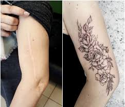Birthmark Cover Up Tattoo Pin On Miscellaneous
