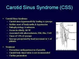 Uncommon Disorders Affecting The Carotid Arteries Lana Schumacher