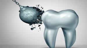 Sudah rilis, ini 7 fitur terbaru windows 11 . What Causes Tooth Enamel Erosion And Can It Be Treated