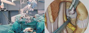 Tell Klinik Bandscheibenvorfall An Der Lendenwirbelsaule