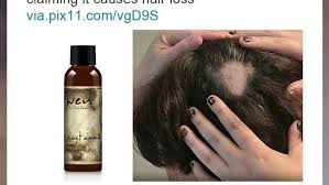 Others say it is greasy and takes the life out of their hair. Hundreds Of Women Claim Wen Hair Products Made Them Go Bald
