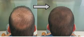Mane Hair Thickening Fibres Travel Pack Mane Uk Ltd