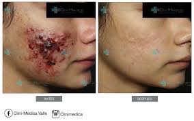 Federico Zaldivar's Instagram, Twitter & Facebook