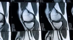 Drug coverage may also be subject to policy guidelines or exclusions established by blue cross and blue shield. X Ray Reader Shields Mri For Mac