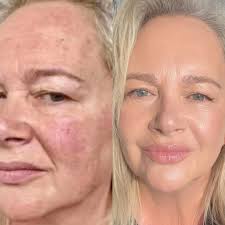 Natural no-makeup look with skincare and foundation