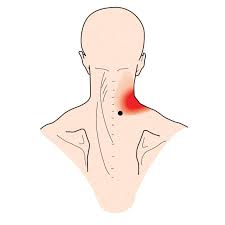 Pin On Health