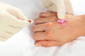 Image result for Peripheral IV Access