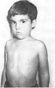 Acta Paediatrica 18. (1977)