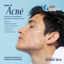Libre de Acné con ayuda de nuestros tratamientos integrales! ✨😍 ¡Agenda tu  cita hoy con nuestra dermatóloga Dra. Marleny Vargas! Llama para hacer tu  cita hoy al: 📲9992-9015 o puedes escribirnos por