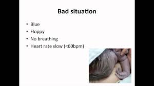 Recently simulation has been incorporated into the curriculum. Paediatrics Neonatal Resuscitation Youtube