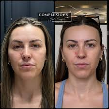 Complexions Beauty Lab