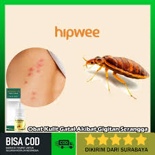 Maka itu, ayo cari tahu apa saja jenis gigitan serangga serta bahaya yang ditimbulkannya! Propolis Sm Obat Kulit Gatal Akibat Gigitan Serangga Ruam Kulit Bintik Merah Bentol Bengkak Shopee Indonesia