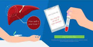 Image result for Liver Function Test