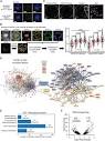 Frontiers | A novel SATB1 protein isoform with different ...