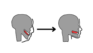 Mewing: more than just a joke? – tjTODAY