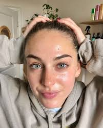 Call me the 🐐🧚🏼‍♀️ ! Swipe for incredible transformation + video  content. Thank y'all for trusting me with your precious skins.  #integrativeesthetican #skinhack #skinhealth #skinrituals #ritualbodystudio  #holisticesthetician #integrativeacne ...