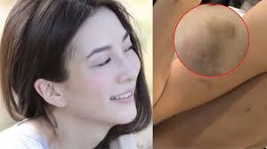ทำเอาหลายคนแอบตกใจ เมื่อสาว เกรซ ชลิตา อดีตแฟนเก่าของพระเอกหนุ่ม พอร์ช ศรัณย์ หลังจากที่มีออกมาโพสต์ดราม่า และคนโยงว่าเกี่ยวข้องกับ หนุ่มพ. Hkzxxogtpq1sim