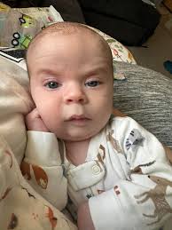 all over ointment helps baby skin issues