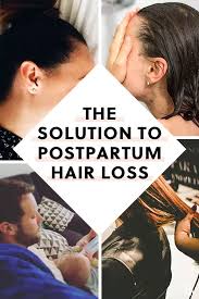 National institutes of health how to. How To Troubleshoot Postpartum Hair Loss Postpartum Hair Loss Hair Loss Hair Loss Remedies