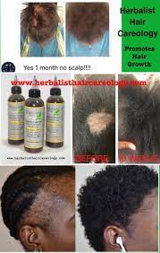 Goddess Strength Hair Growth Oil Great Reviews Etsy Hair Growth Oil Oil For Hair Loss Hair Loss Remedies