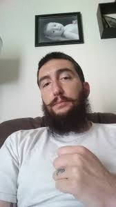 Hair cut beard trimed. And you can see some of the tumors