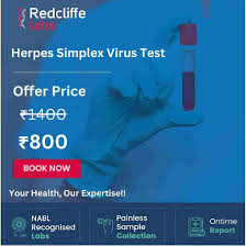 Image result for Herpes Simplex Virus Testing