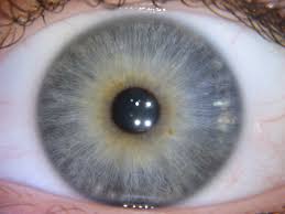 It does not cause problems with vision and does not need treatment. Nerve Rings Iridology Examples Images Iriscope Iridology Camera Iriscope Camera Iridology Chart Iridology Iriscope Org