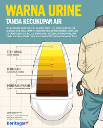 Jika sakit saat kencing terjadi pada awal atau saat buang air kecil sebagai upaya pengobatan awal, anda bisa memperbanyak konsumsi air putih dan hindari kebiasaan menahan kencing terlalu lama. Warna Urine Menandakan Kecukupan Air Dalam Tubuh