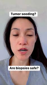 I have been asked by this numerous time. I have attached the article for  your review. Let me know what you think.  https://pmc.ncbi.nlm.nih.gov/articles/PMC3473763/