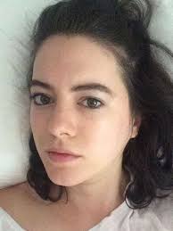 How I Semi Permanently Removed My Under Eye Bags Under Eye Bags Eye Bags Undereye