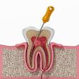 Root Canal Treatment product image