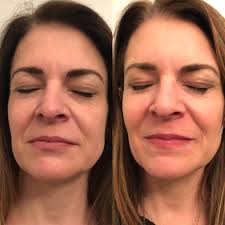 Glo Esthetics In Alpine UT