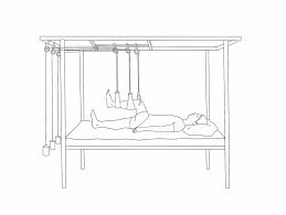 See that the weights hang freely without touching the bed, bedding, and the body of the client. Cureus Keeping The Traction On In Orthopaedics