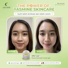 Real Testimoni Yasmine Skincare