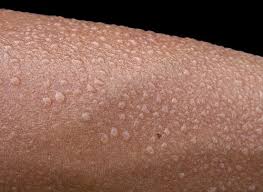 Memory foam added with cooling gel provides a cooler surface for hot months. Welche Matratze Bei Schwitzen Matratzen Test 2021